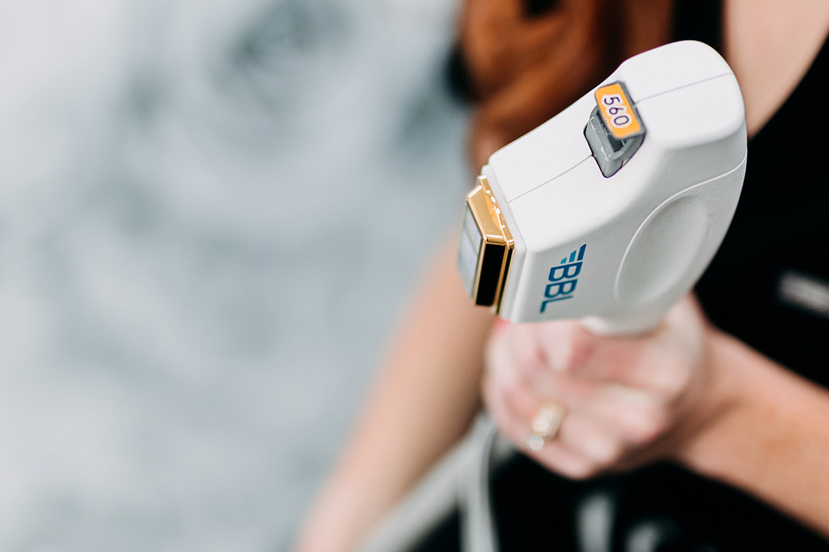 BroadBand Light (BBL) in Shelby Township, MI | XO Aesthetics