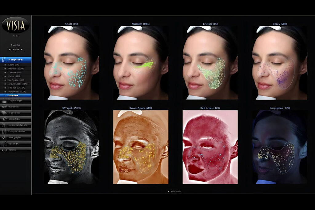 Visual Skin Depth Inches VISIA Skin Analysis in Shelby Township, MI | XO Aesthetics